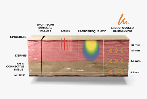 ultrasound